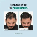 Nutrafol Men's Hair Growth Supplements Pack of 3, Clinically Tested for Visibly Thicker Hair and Scalp Coverage, Dermatologist Recommended - 1 Month - Jia Sales
